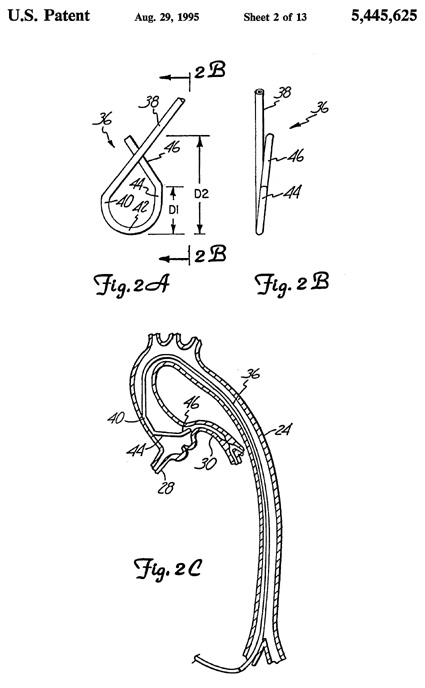 625特許のカテーテルを示す説明図